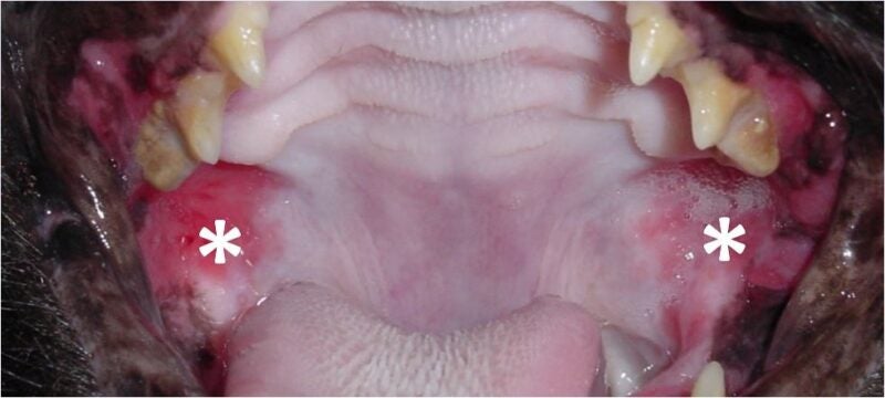 Stomatitis