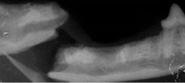 Webinar – 9/8/20 – Managing Tooth Extraction Complications – VDOS (fee applies)