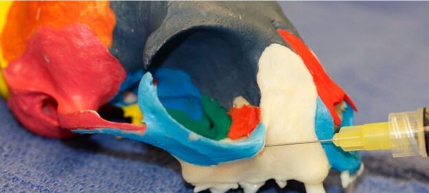 Webinar – 9/3/20 – Dental Nerve Blocks (Regional Analgesia) – VDOS (fee applies)