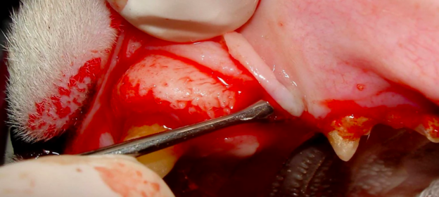 Webinar – 11/15/20 – Closed and Open Tooth Extraction – VDOS (fee applies)