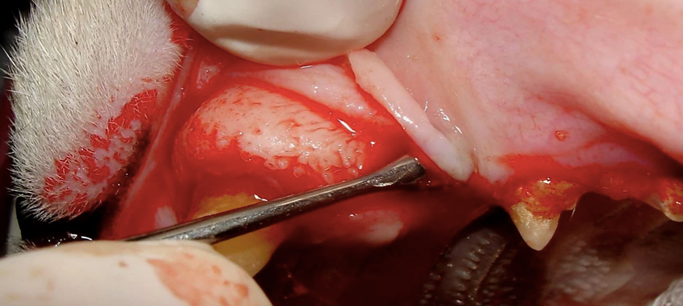 Open and Closed Tooth Extraction