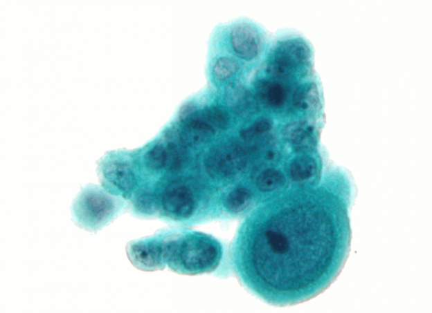 Webinar – 6/24/21 – Cytology for Shelters – Texas Unites (fee applies)